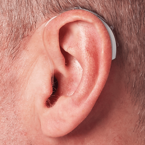 Behind The Ear (BTE) - Audibel Kenya